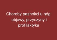 Choroby paznokci u nóg: objawy, przyczyny i profilaktyka