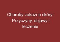 Choroby zakaźne skóry: Przyczyny, objawy i leczenie
