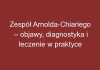 Zespół Arnolda-Chiariego – objawy, diagnostyka i leczenie w praktyce