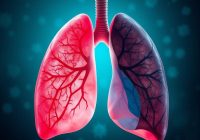 Gruźlica: objawy, diagnostyka i leczenie – co warto wiedzieć?